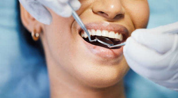 Best Urgent Care for Lost Fillings or Crowns in Hurley, MS